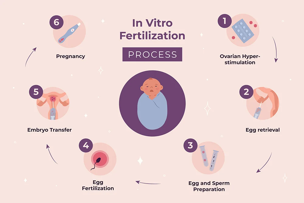 In Vitro Fertilization Process